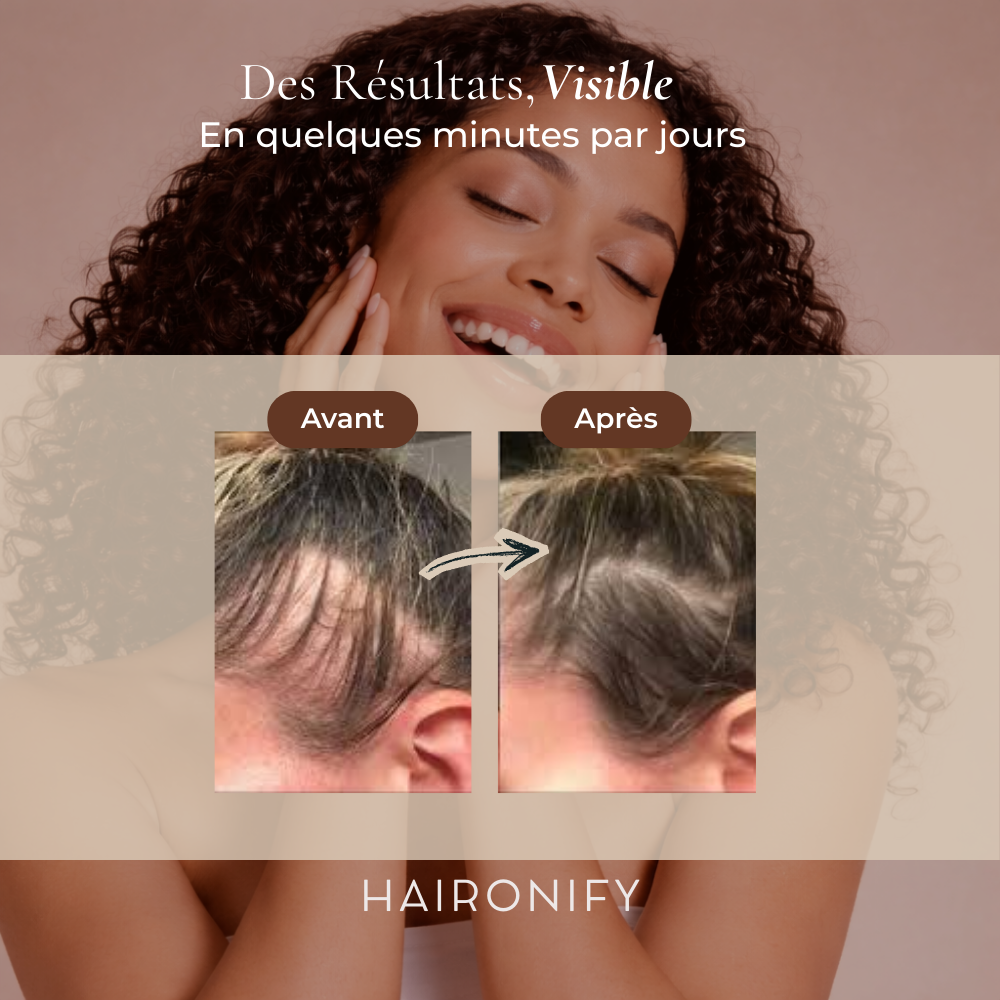 Haironify – Traitement Haute Fréquence Capillaire