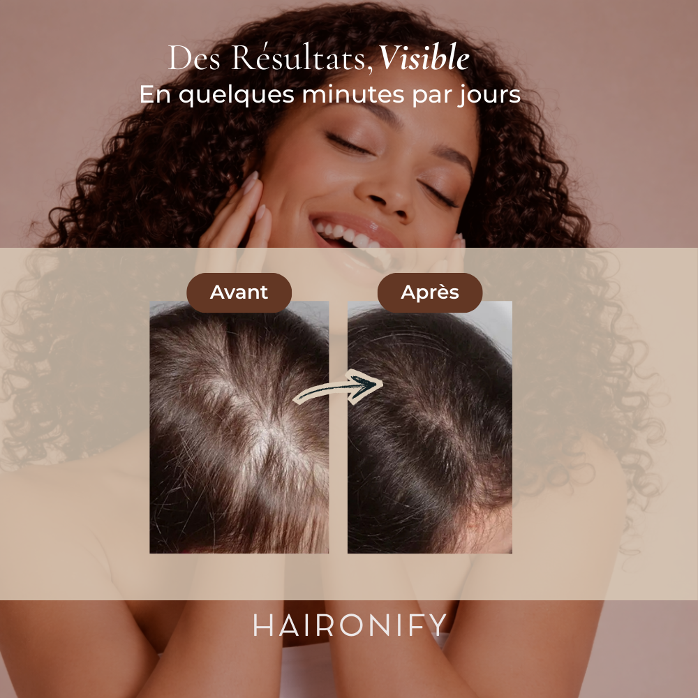 Haironify – Traitement Haute Fréquence Capillaire